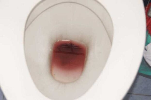 ប្រទះឃើញបុរសនៅពេលរំភើប